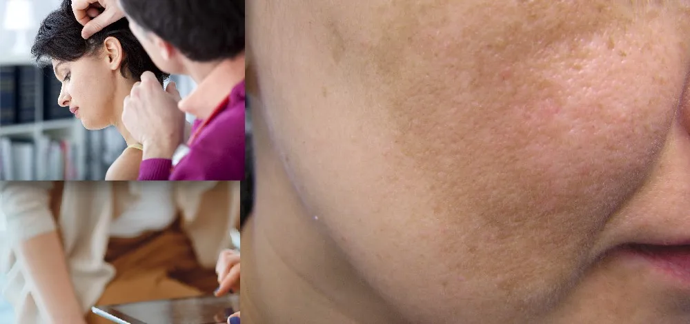 Как избавиться от нежелательной гиперпигментации и вернуть коже равномерный, сияющий тон